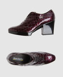 ALBERTO GUARDIANI SPORT - Chaussures à lacets