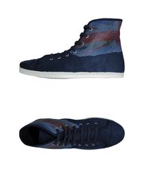 3:10 - High-tops