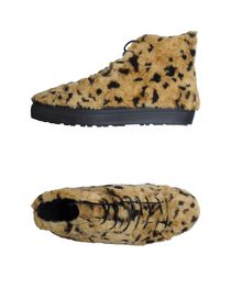 FORFEX - High-tops